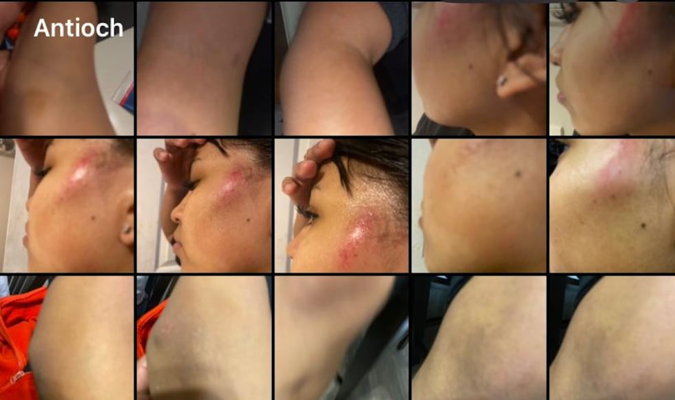 La madre de la menor nos proporcionó esta fotografía asegurando que esos golpes los recibió su...