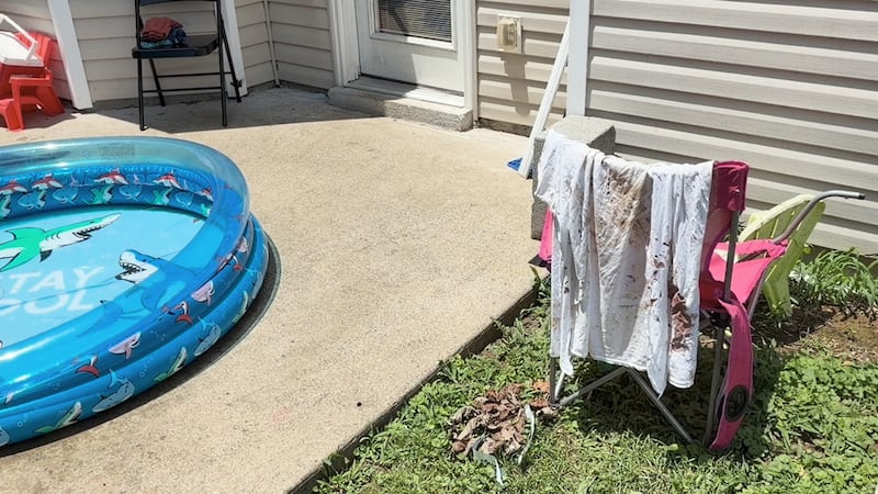 Familia salvadoreña resulta gravemente herida tras ataque de un pitbull en Antioch