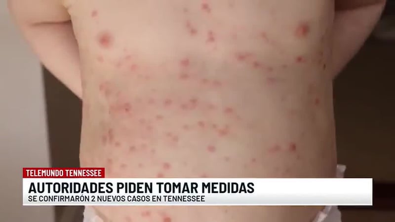 Noticias Telemundo Tennessee - julio 15, 2026